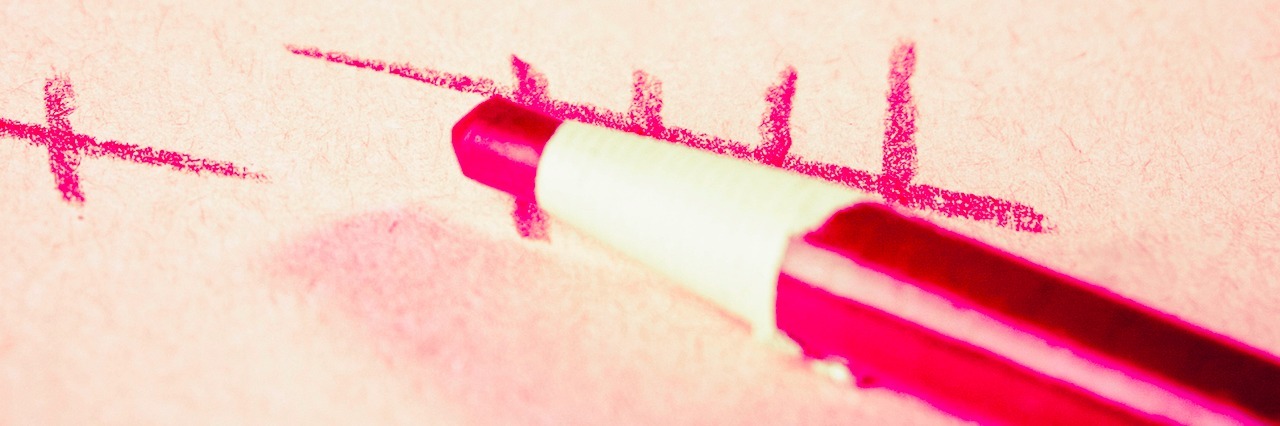 Black and White Thinking in OCD Recovery pencil drawing tally marks