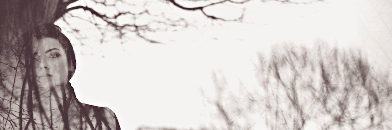 Experiencing Anesthesia-Related Amnesia After Surgery woman leaning against a tree