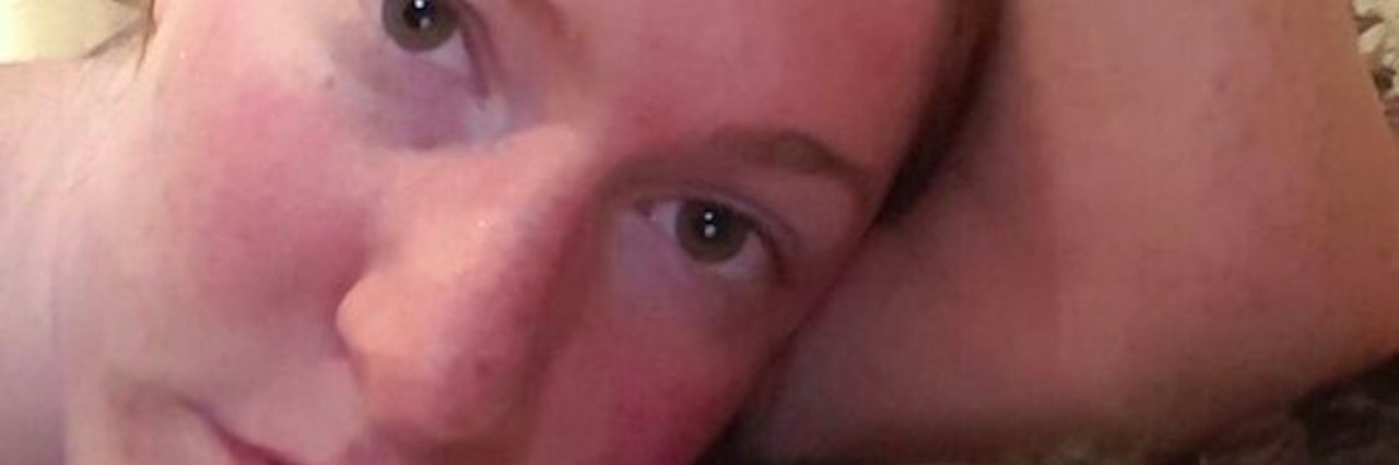 The Katy Perry Song That Describes Dysautonomia Symptoms woman resting her head on her arm