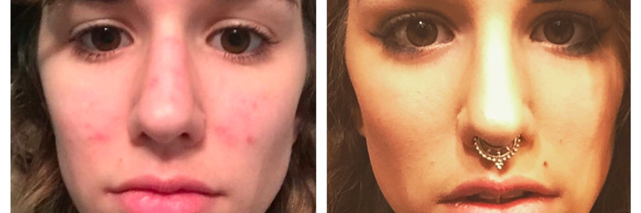 How Society's Beauty Standards Affected My Struggle with BFRBs A collage of side by side images of the same woman with and without makeup