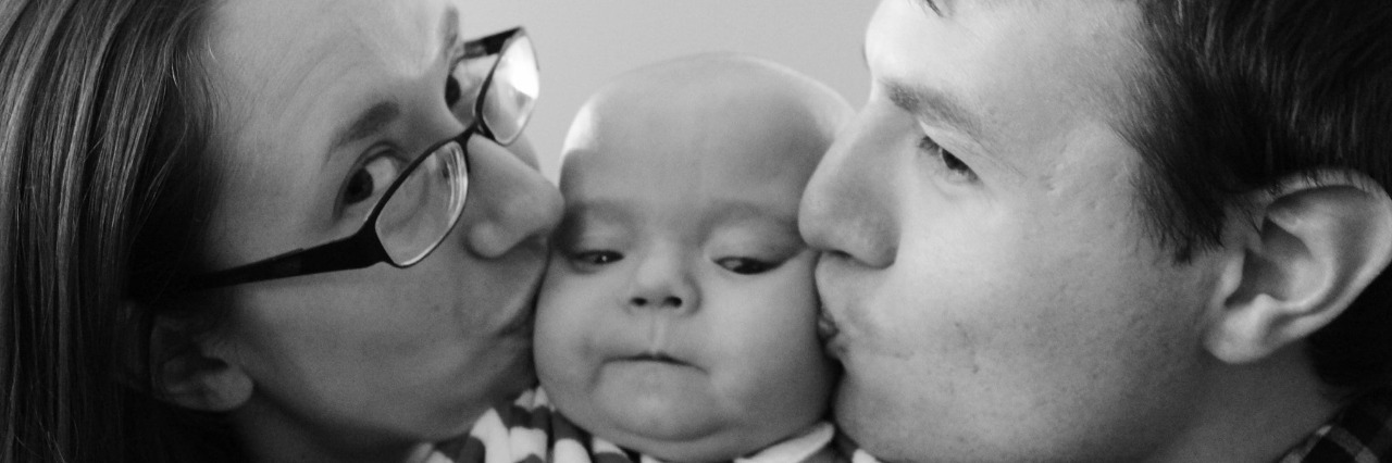 What Anxiety Looks Like in My Life as a Special Needs Mom Marie with her husband kissing Benjamin
