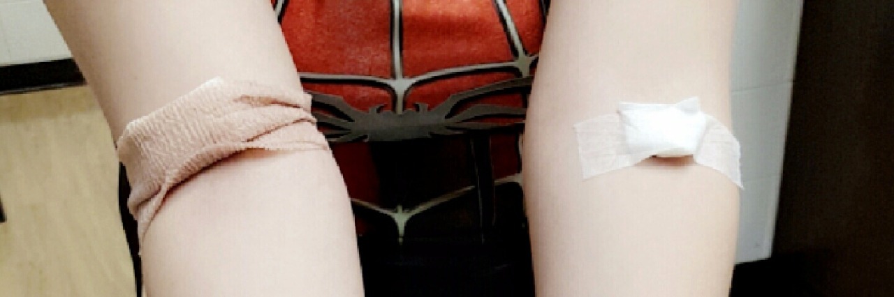 What I Did When Doctors Told Me I Was Faking My Pain arms After a Blood Test