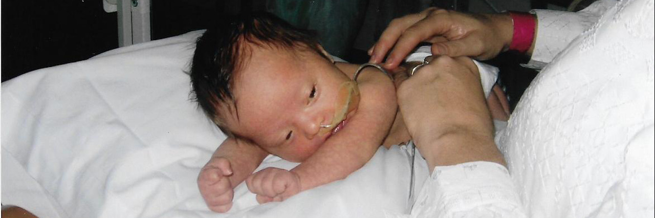 Advice for Medical Staff After a Down Syndrome Diagnosis Baby George in the hospital.