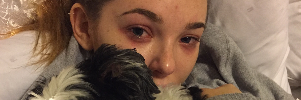 Posting a Picture of Social Media After a Panic Attack Hannah Wiles