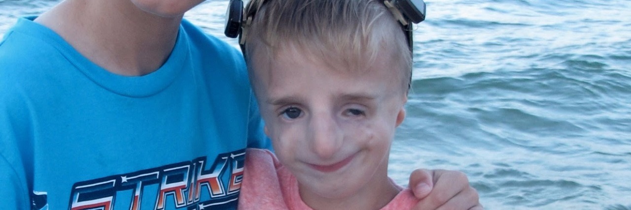 What Perspective Means When Your Child Has a Craniofacial Disorder Liz's son and daughter