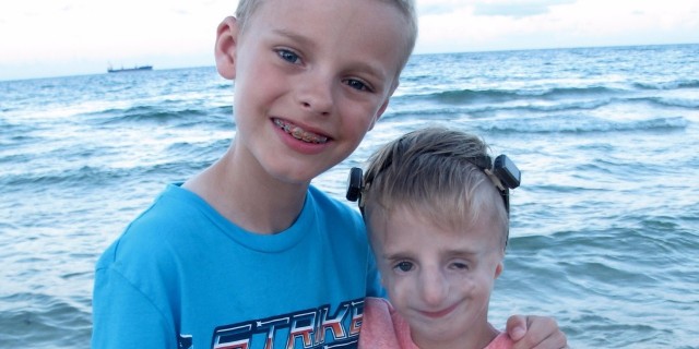 Why Perspective Matters When Parenting a Child With a Craniofacial Disorder Liz's son and daughter