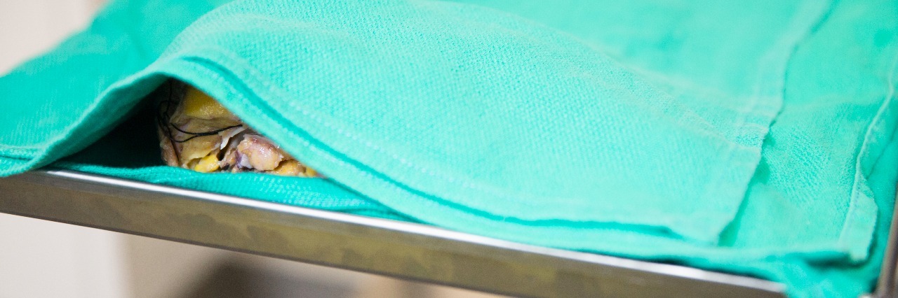 heart after transplant covered in green sheet