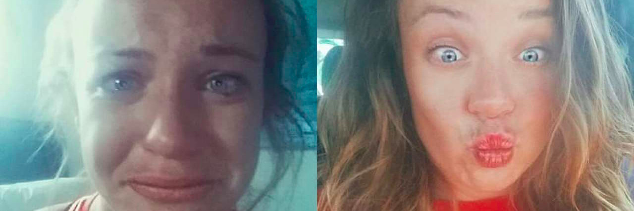 What Anxiety Is Like On the right: A woman crying during an anxiety attack. On the left: A woman making a kiss face