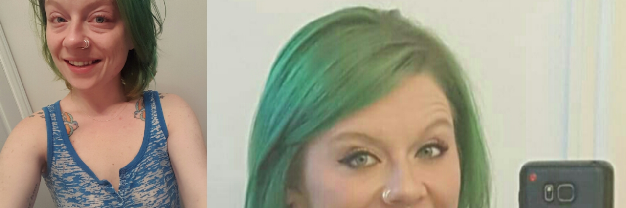 Woman With Crohn's Responds to 'But You Don't Look Sick...' selfies of a woman with crohn's disease with and without makeup