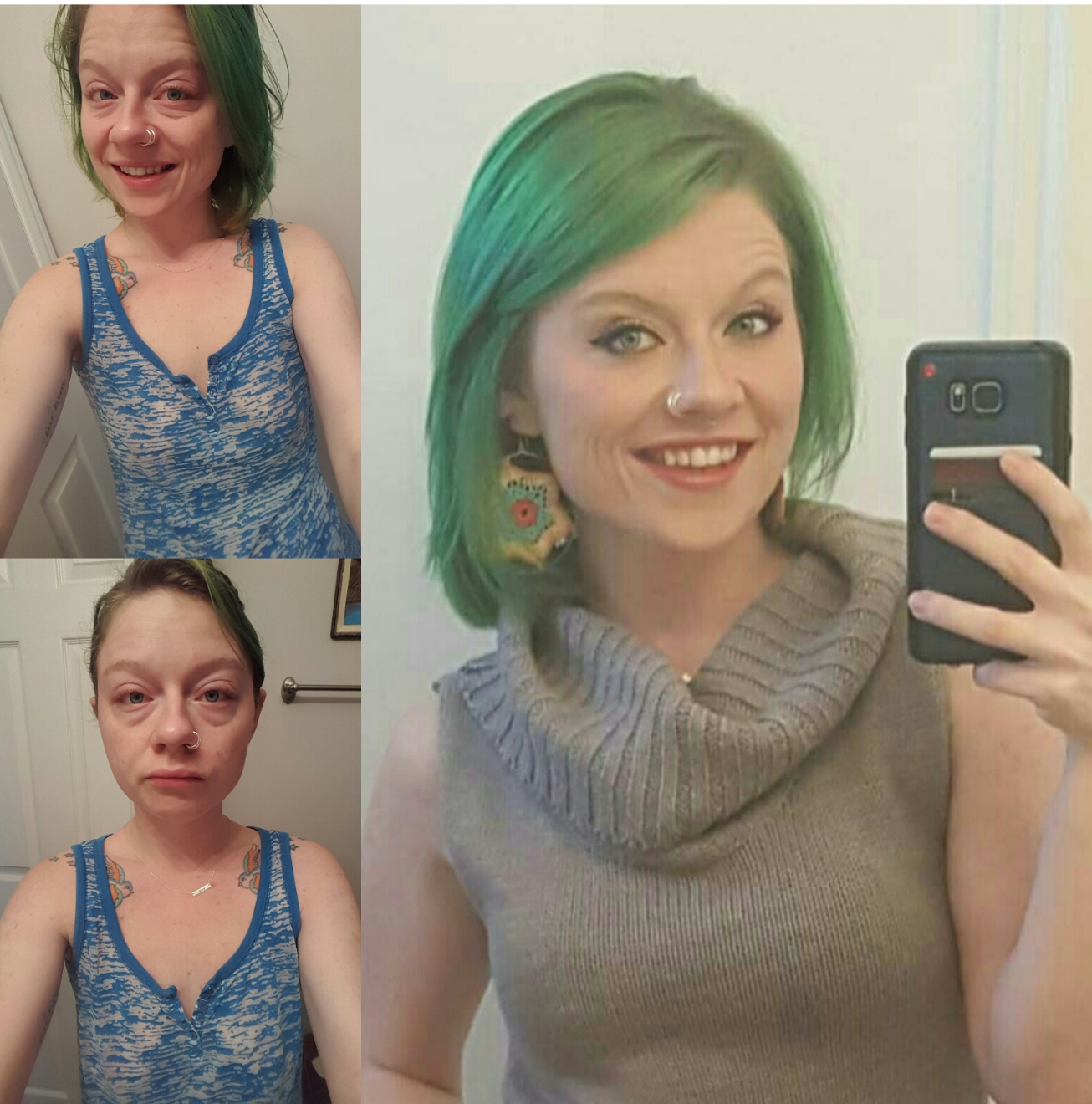 selfies of a woman with crohn's disease with and without makeup