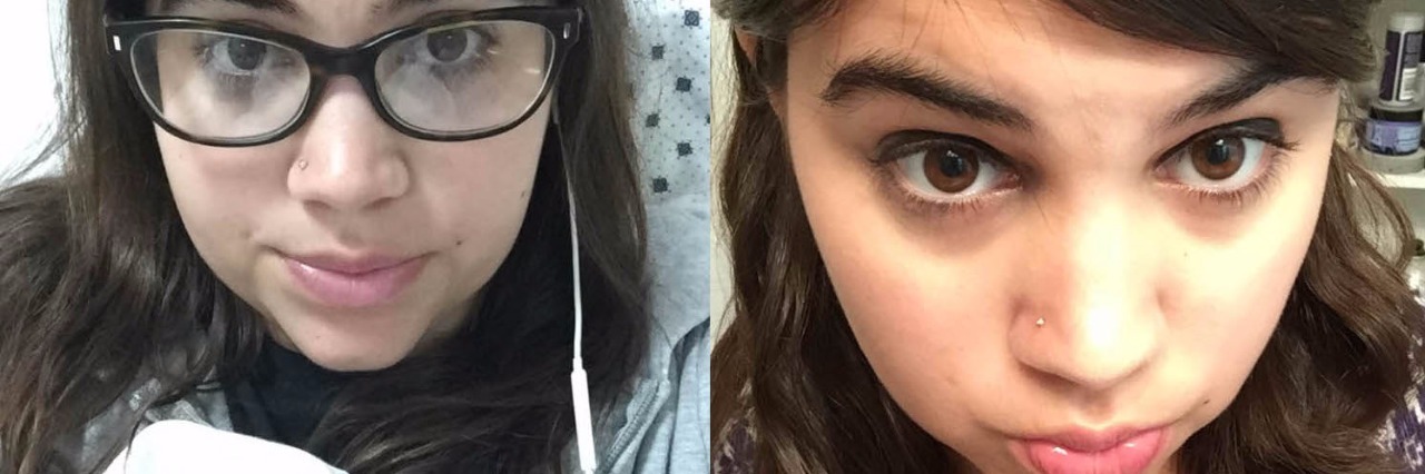 Selfies During Hospital Visits Ilana's hospital selfie next to Ilana's non-hospital selfie