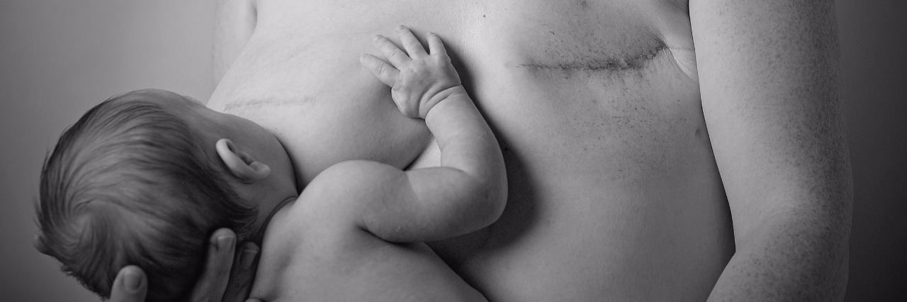 Breast Cancer: Breastfeeding and Body Acceptance After My Mastectomy A black and white photo of the author breastfeeding after her single mastectomy