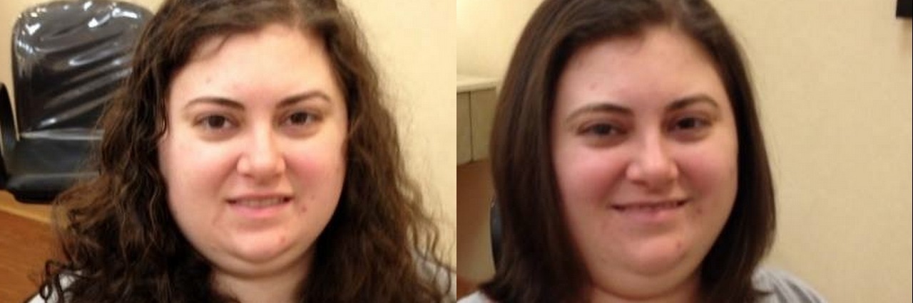 Hairdresser Tells Woman With Psoriasis She Can't Cut Her Hair before and after haircut photos o fa woman with brown hair