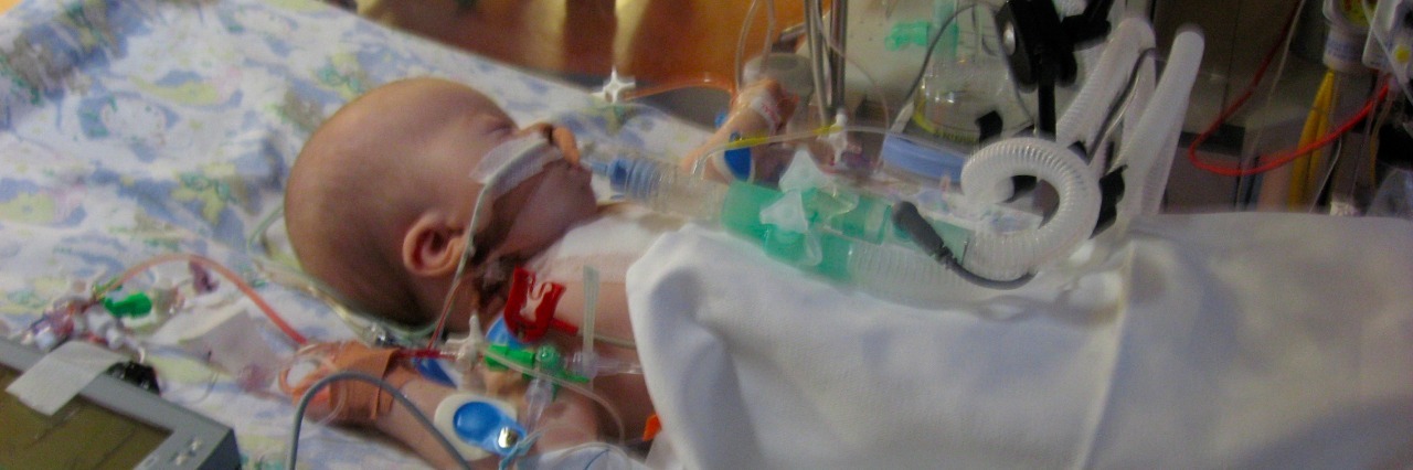 Coping After Surgery for Your Child's Congenital Heart Defect Michelle's daughter in the ICU