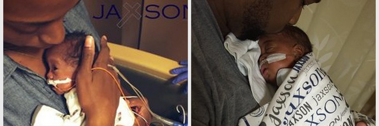 Dealing With Sadness That Can Come After Your Baby’s Premature Birth Two photos of a man holding a baby born prematurely on his chest
