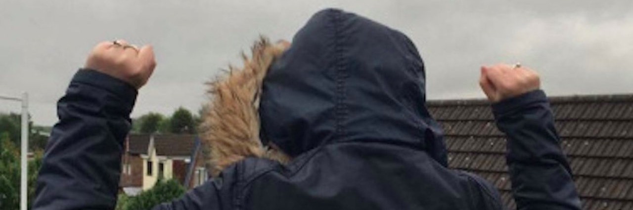 Woman With Hypothyroidism Reaches Top of Stairs Without Crawling woman raising her arms above her head