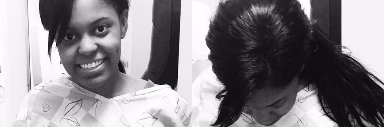 Feeling Thankful for My Ostomy as a Woman With Ulcerative Colitis woman standing up in a hospital gown and revealing her ostomy