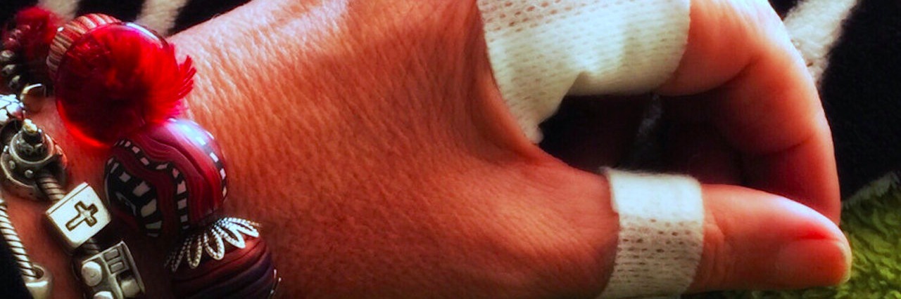 Letter to the Hand Specialist Who Acted Like Judge and Jury bandages on woman’s hand