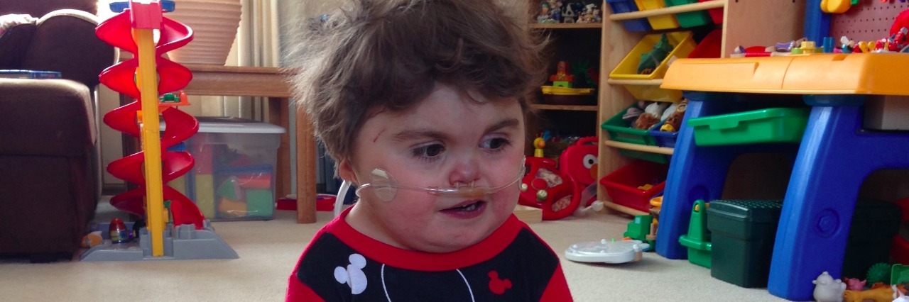 Dual Dignoses: My Child Has CHARGE Syndrome and a Heart Condition a baby hooked up to an oxygen machine sitting on the floor of a playroom