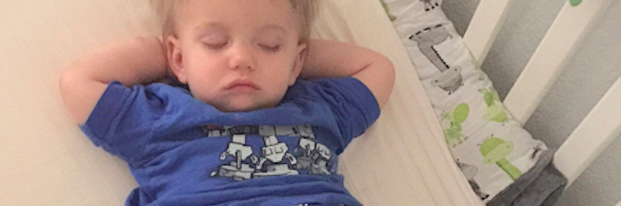 Mother Is Tired of Explaining Her Child’s Differences to Strangers little boy lying down