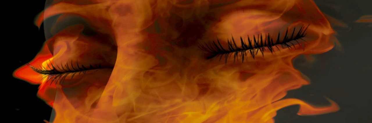 What the Pain of Suicidal Thoughts Feels Like illustration of a woman who's face is covered in flames
