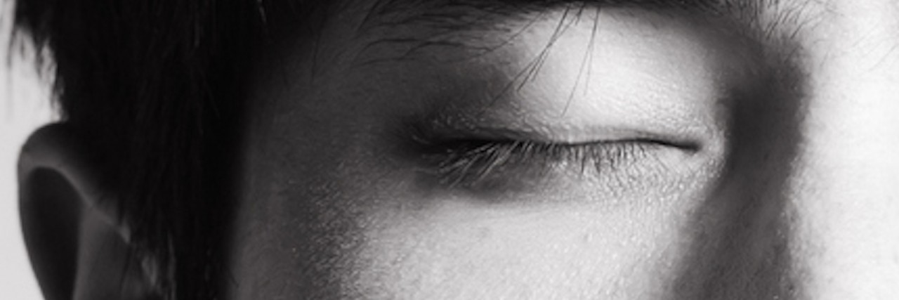 What It's Like to Have Photophobia Man with eyes closed