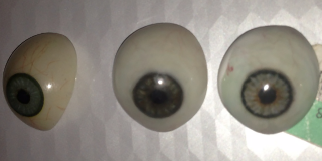 These are several examples of scleral shell eye prosthetics I have worn over the years. Each one costs over $3,000 so why wouldn’t I keep them. The left one was my second manufactured eye prosthetic that I wore throughout elementary school. The ones beside it and the one I wear now are handmade, and fit and look better than the manufactured eyes.