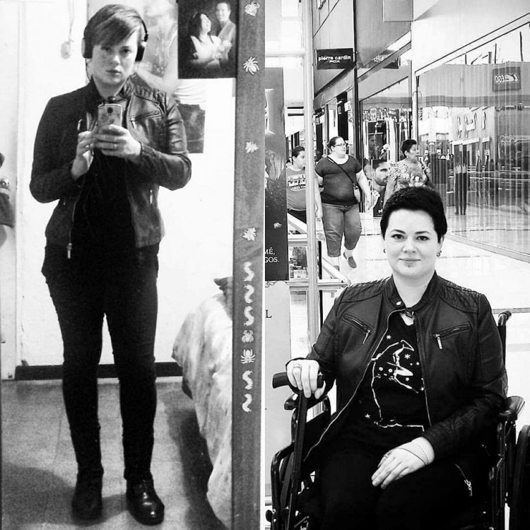 black and white photo of girl standing and of her sitting in wheelchair