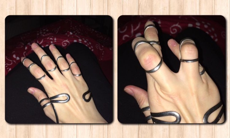 fingers with silver splints