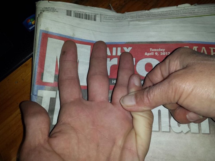 hand on newspaper with pinky bending the wrong way