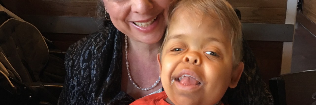 The Spectrum of Thanatophoric Dwarfism mom and son with dwarfism