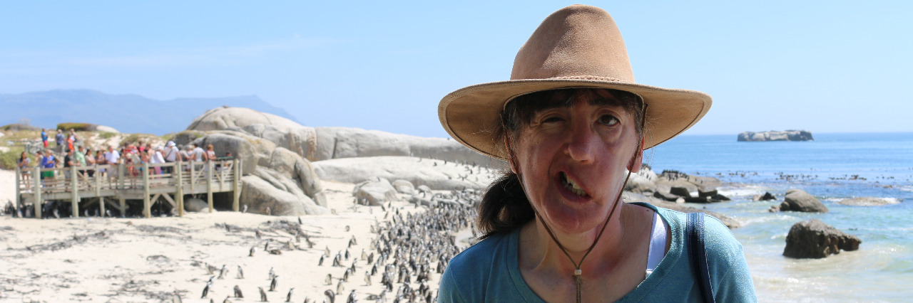 Traveling With a Facial Difference With the penguins at Boulder Beach.