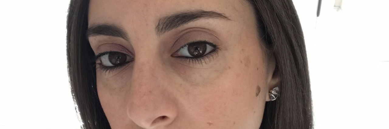 Finding Strength Despite Chronic Muscle Weakness woman with dark hair and a black and white shirt takes a selfie