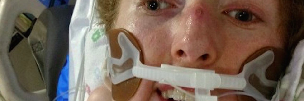 Mother Is Thankful for Ventilator That Saved Her Child young man on a ventilator in the hospital