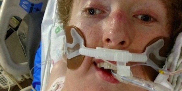 When I Realized Everything I Thought I Knew About Ventilators Was Wrong young man on a ventilator in the hospital