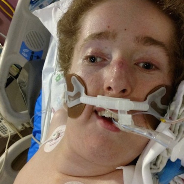 young man on a ventilator in the hospital
