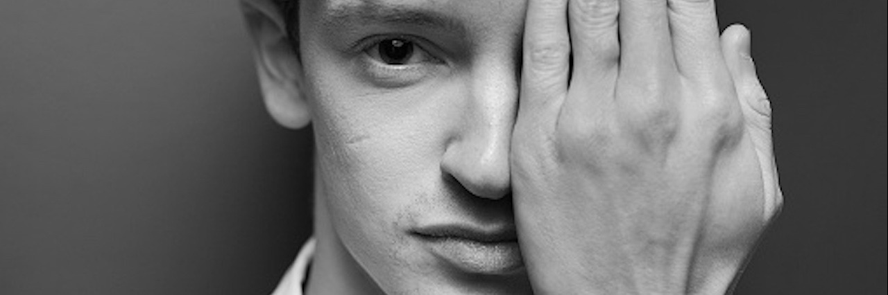 Young man with his hand covering half of his face