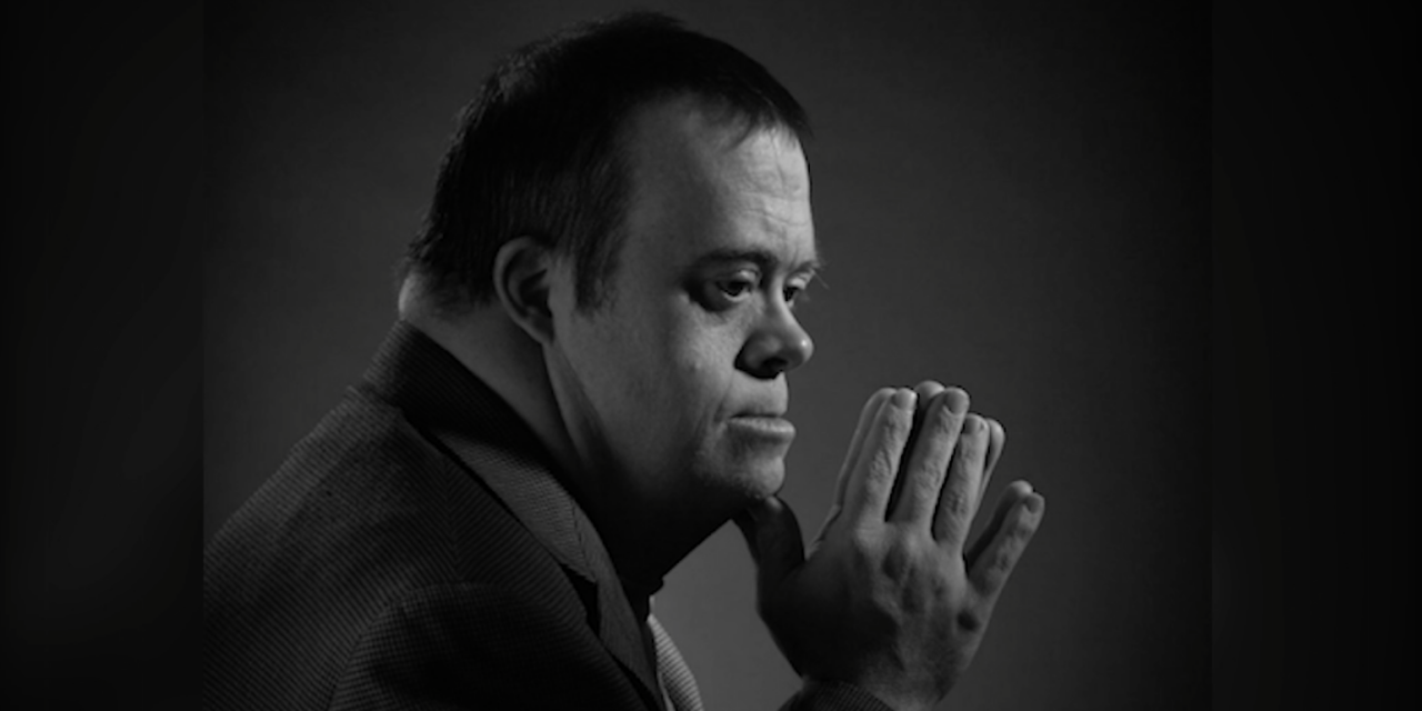 Beyond The Stereotype The Reality Of Being Thin With Down Syndrome - 5jjj4yc