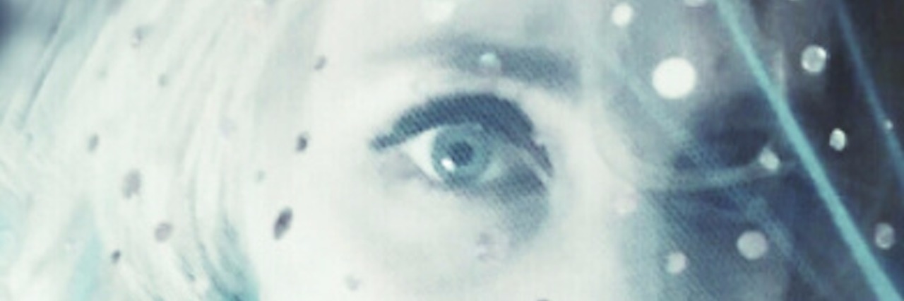 Learning to Accept 'New Normal' of Chronic Illness Black and white photo of woman, slightly blurred