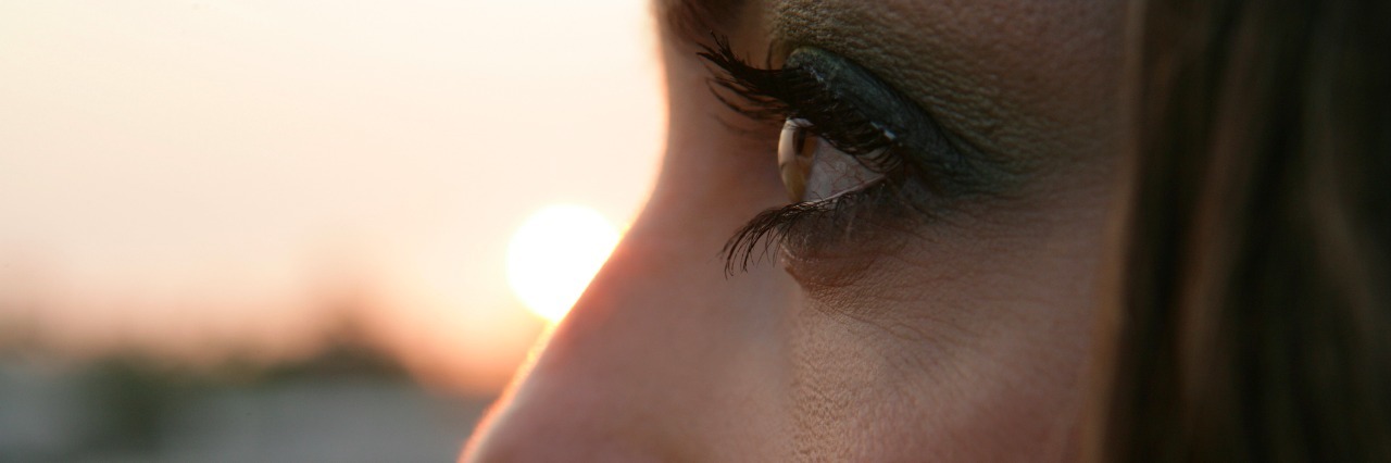 Finding Acceptance in My RSD/CRPS, Chronic Illness and Disability Close-up profile of young woman's face.