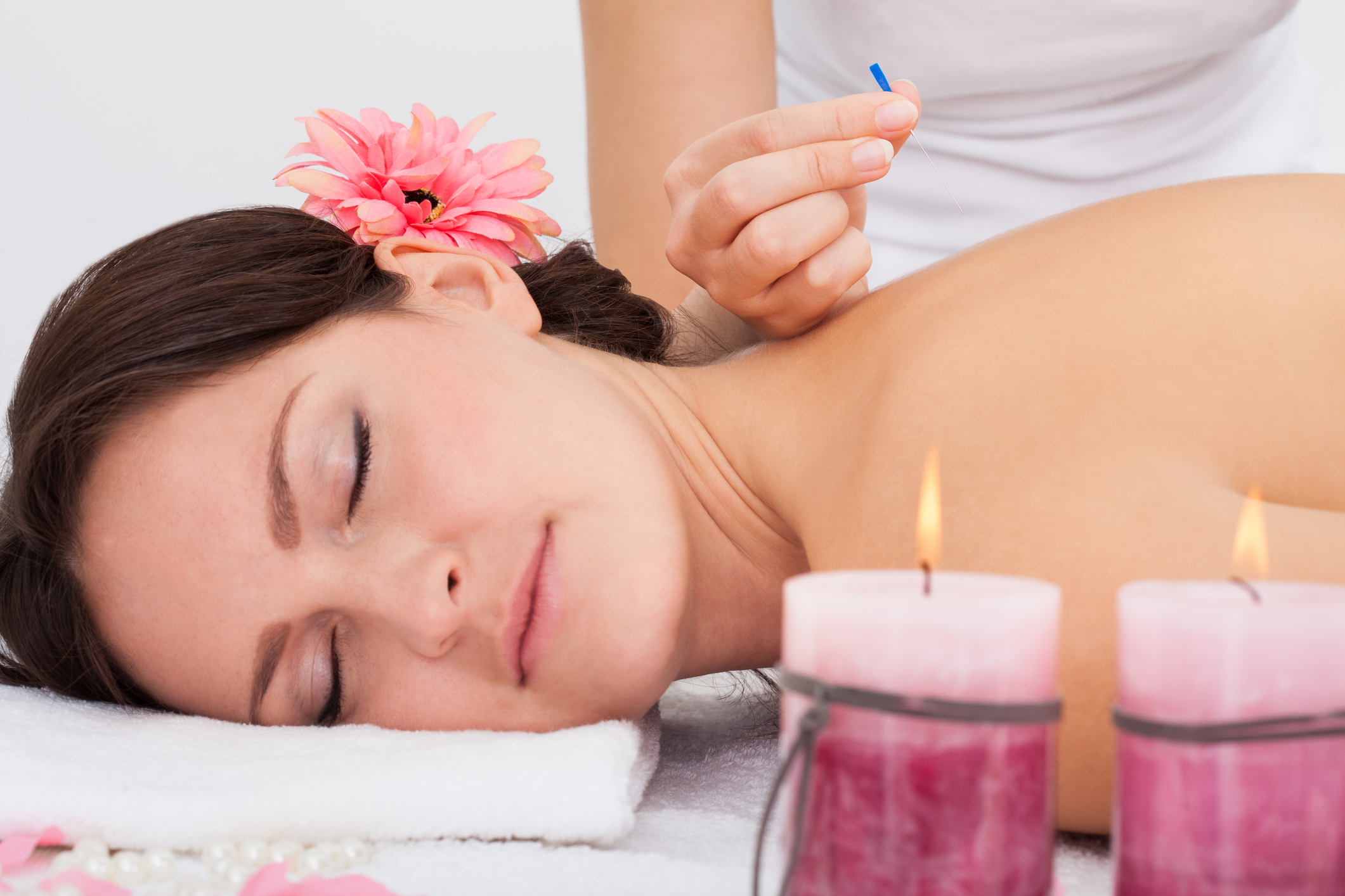 woman receiving acupuncture therapy while laying on a bed next to pink candles