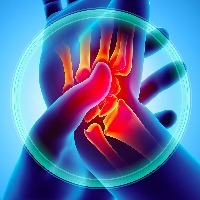 Illustration of carpal tunnel syndrome, someone holding a painful wrist