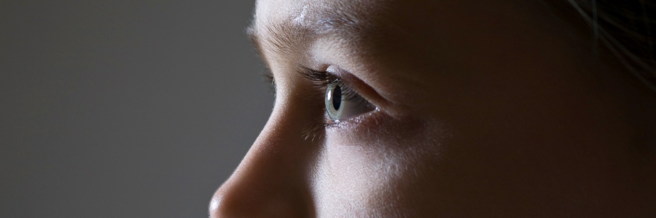 What It Was Like to Grow Up With Ehlers-Danlos Syndrome Studio portrait of girl, close-up