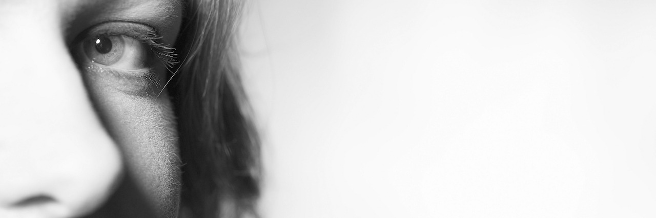 I Feel Like I Have to 'Prove' I Have Bipolar Disorder Cropped shot of half of a woman's face