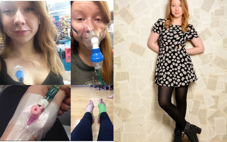 photos of girl wearing oxygen mask and iv next to photo of girl wearing a black and white dress