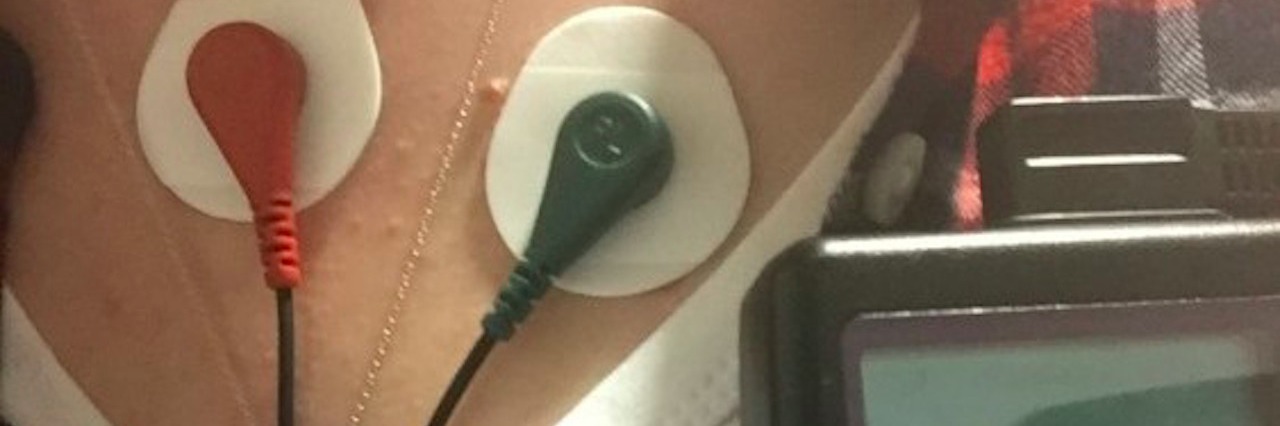 When You're in Between Chronically Sick and Healthy woman's chest with two lines and electronic tool