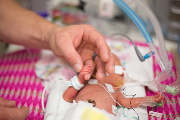 mother holding the hand of a micro preemie in the nicu