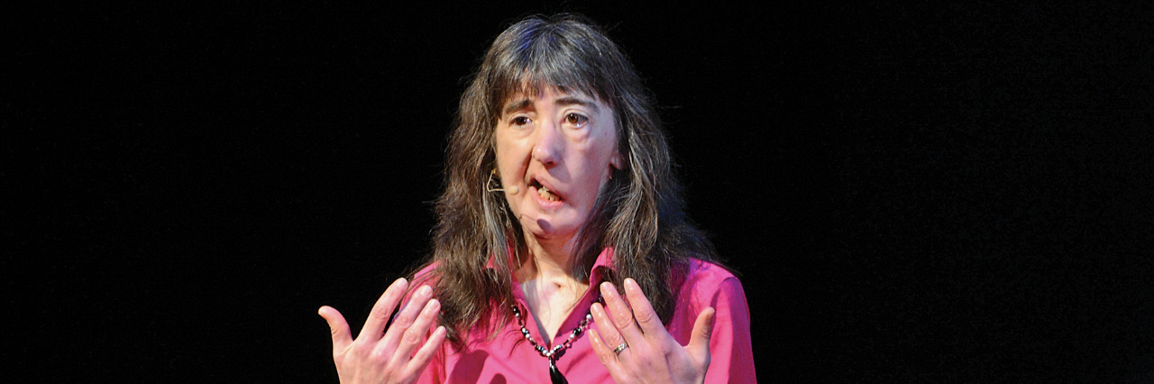 Being Seen and Heard as a Person With a Facial Difference Dawn Shaw giving a TEDx talk.
