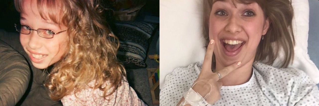 photo of girl when she was younger and photo of her more recently, in the hospital