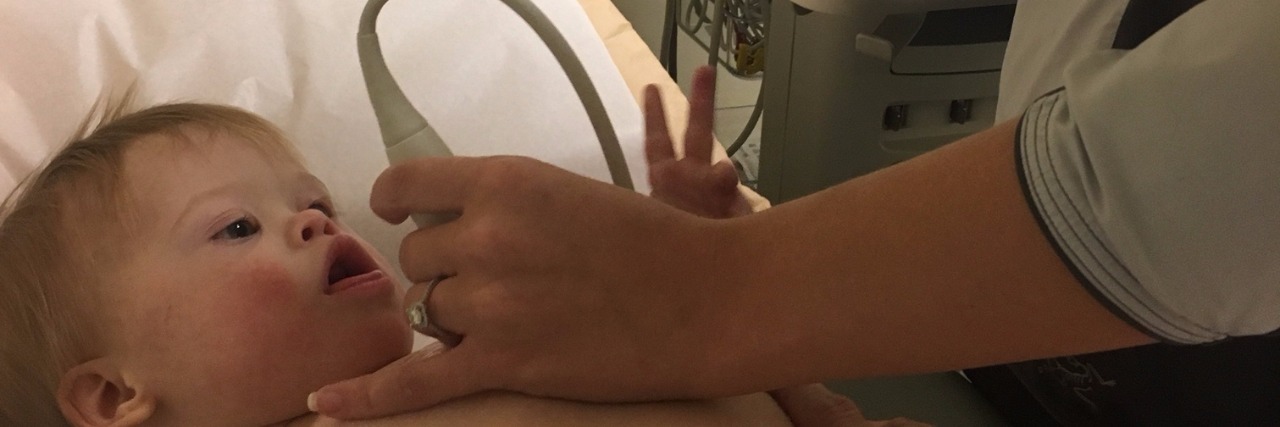 Worrying About Unknowns as the Mom of Child With Down Syndrome Baby having a heart exam in the hospital